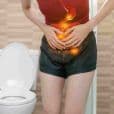 Irritable Bowel Syndrome image 2