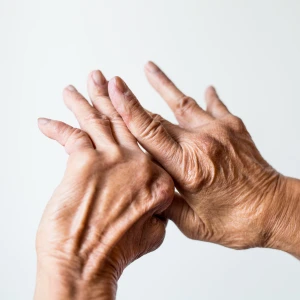 Psoriatic Arthritis image 2