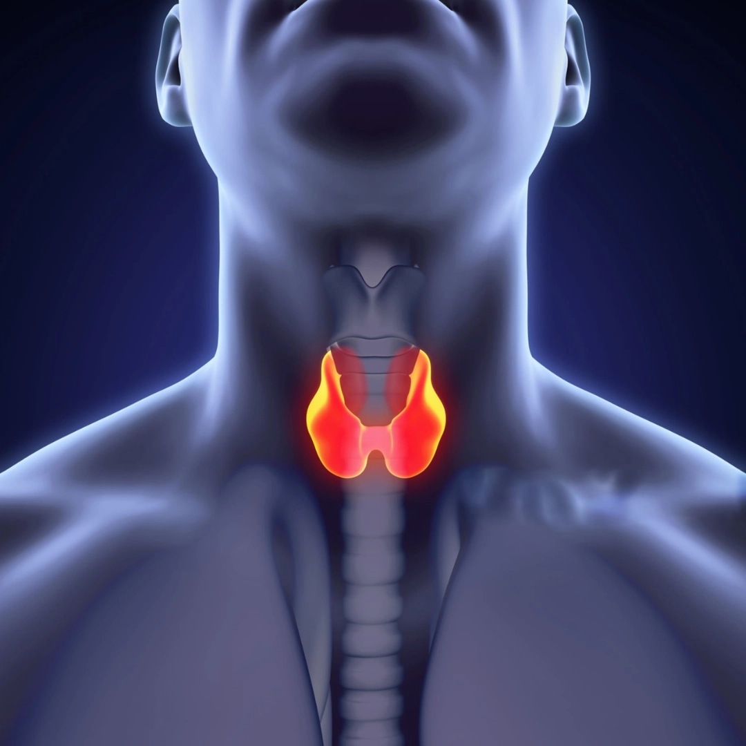 Underactive Thyroid image 1